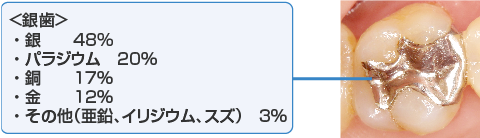 メタルフリーへの取り組み