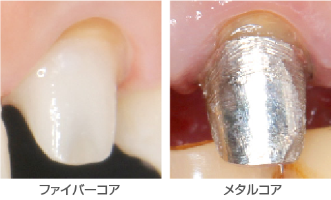 メタルフリーへの取り組み